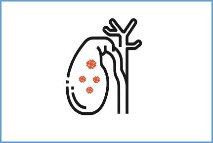 Homo sapiens / Gallbladder Cancer